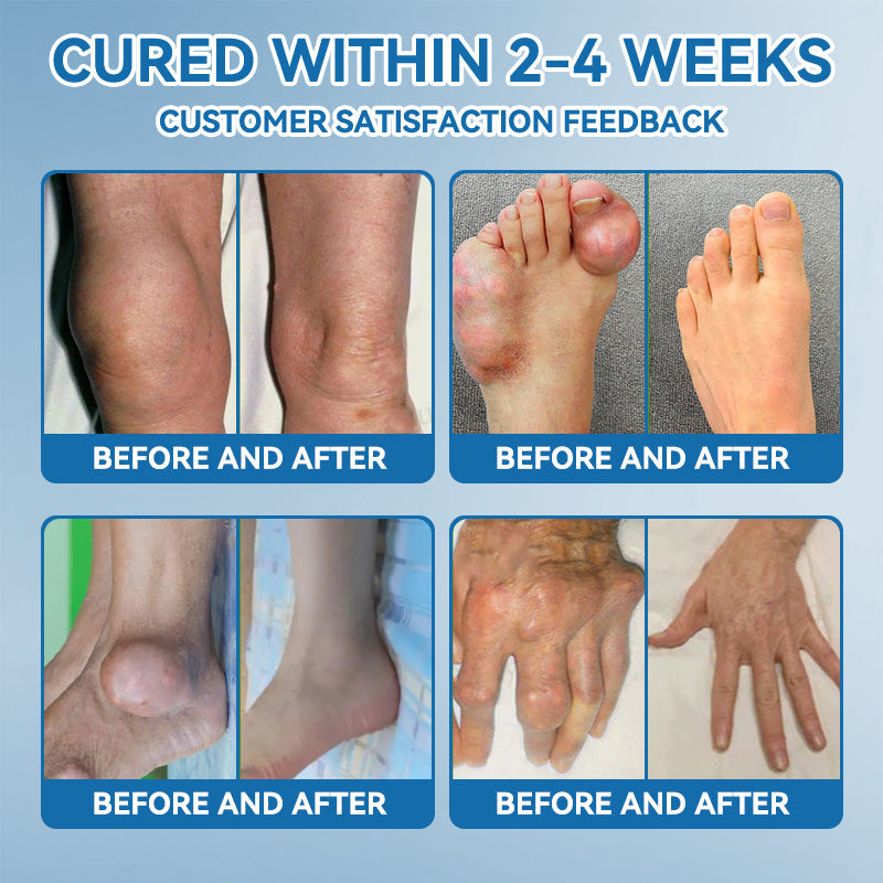 𝐅𝐃𝐀 𝐀𝐩𝐩𝐫𝐨𝐯𝐞𝐝👩‍⚕️|LOVILDS® 𝑩𝐏𝐂-𝟏𝟓𝟕 𝐉𝐨𝐢𝐧𝐭 𝐇𝐞𝐚𝐥𝐢𝐧𝐠 𝐂𝐫𝐞𝐚𝐦🦴 Relief for Arthritis, Neuropathy, Rheumatism & Sports Injuries & 𝐌𝐨𝐫𝐞