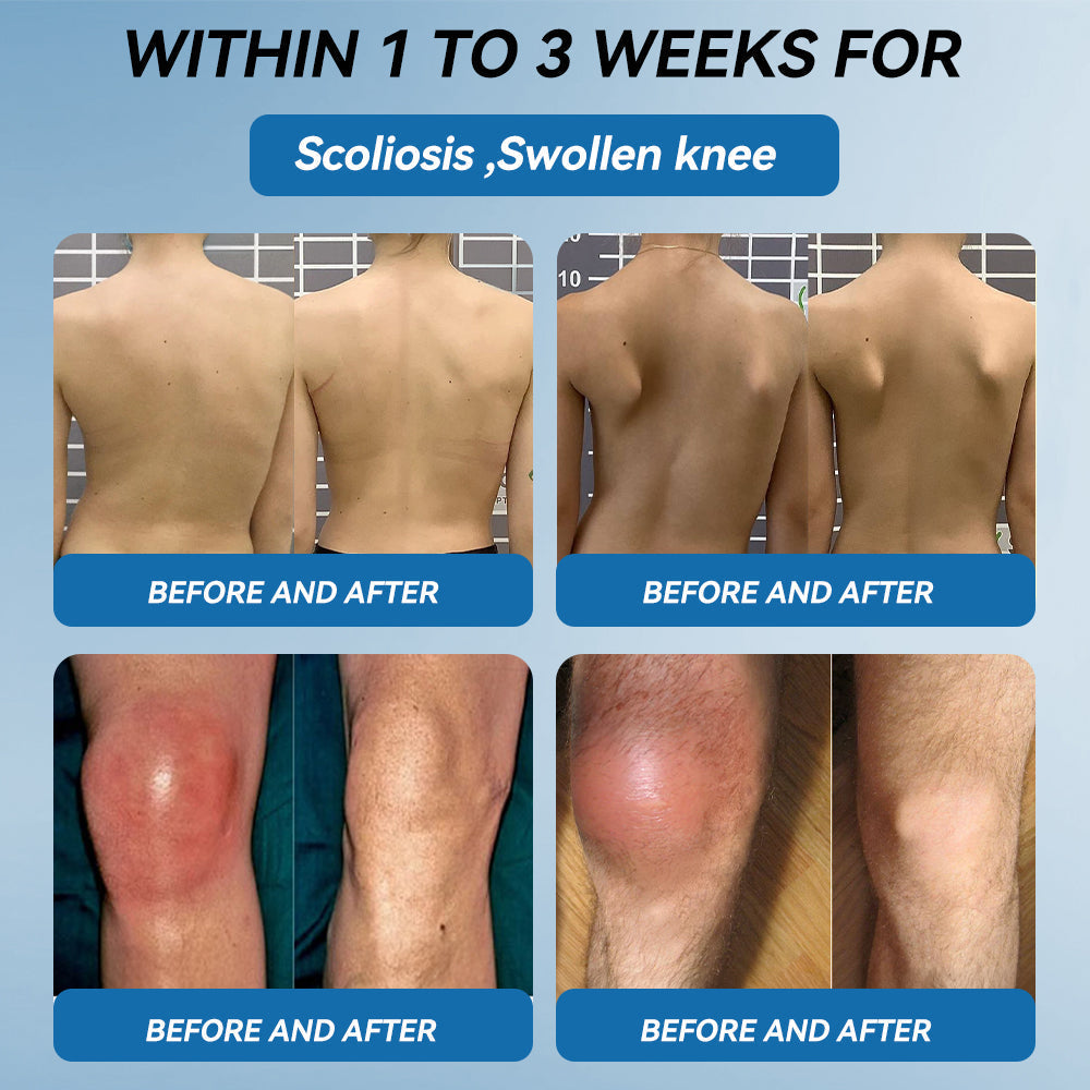 𝐅𝐃𝐀 𝐀𝐩𝐩𝐫𝐨𝐯𝐞𝐝👩‍⚕️|LOVILDS® 𝑩𝐏𝐂-𝟏𝟓𝟕 𝐉𝐨𝐢𝐧𝐭 𝐇𝐞𝐚𝐥𝐢𝐧𝐠 𝐂𝐫𝐞𝐚𝐦🦴 Relief for Arthritis, Neuropathy, Rheumatism & Sports Injuries & 𝐌𝐨𝐫𝐞