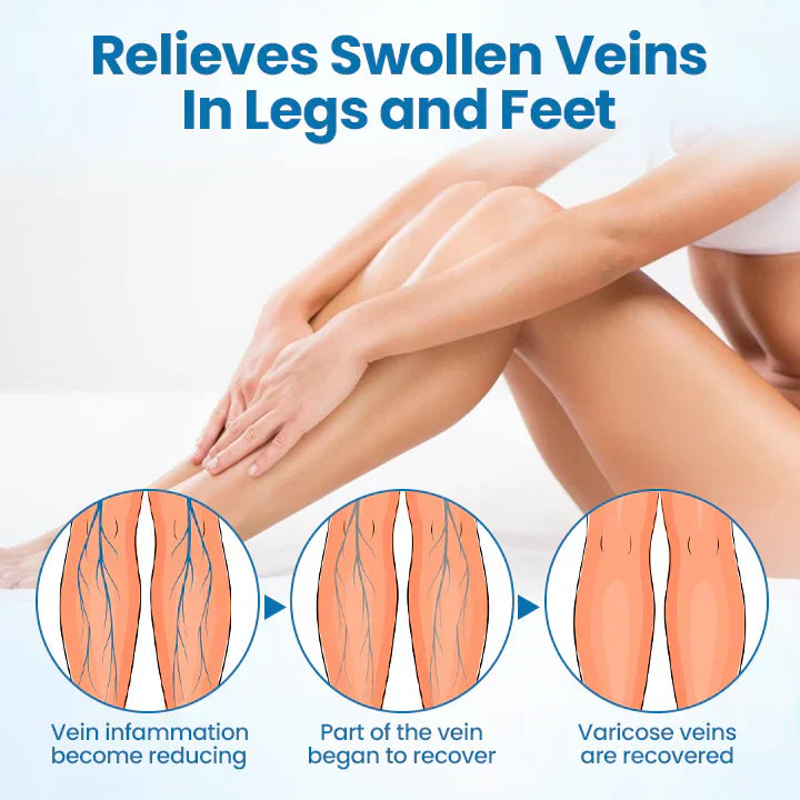 Nexisify® VeinGuard Herbal Spray-✅ Clinically proven to eliminate varicose veins in just 7 days!