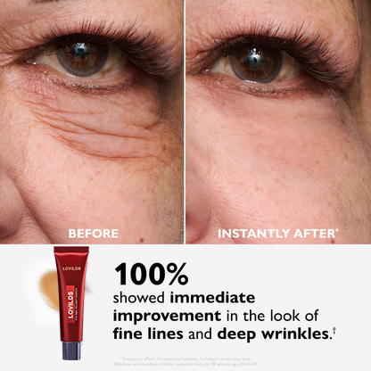 Eye Bag Eraser — Instantly Refreshes, Firms & Smooths for a Youthful Look That Lasts 8 Hours-1