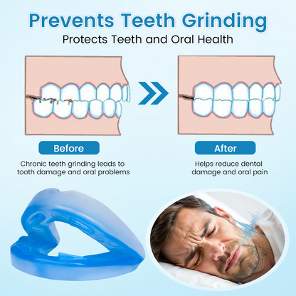 PerfectSleep Solution - SmileFitPro™ Anti-Snoring & Anti-Grinding Teeth Protector