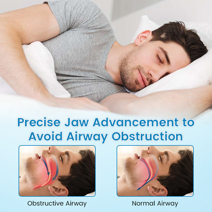 PerfectSleep Solution - SmileFitPro™ Anti-Snoring & Anti-Grinding Teeth Protector
