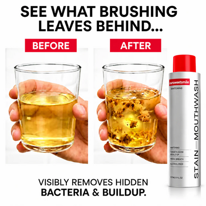 OurSweetSmile™ Gunk Removing Mouthwash